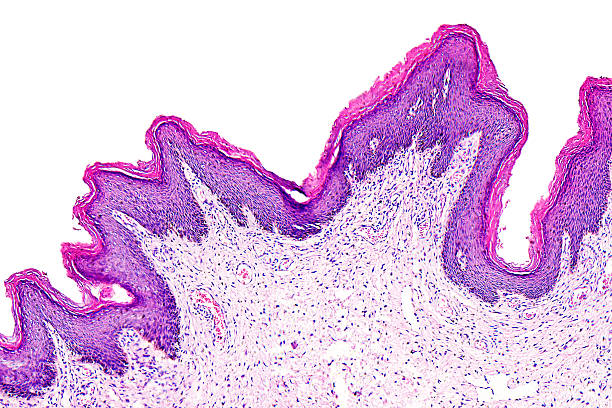 papiloma de la piel de un humanos - microscope slide fotografías e imágenes de stock