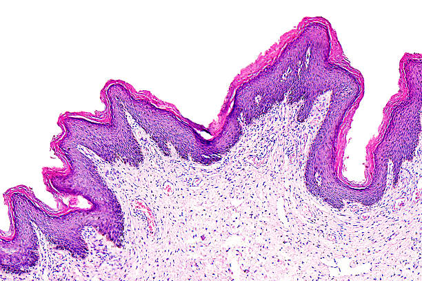 skin brodawczak z ludzkiego - scientific micrograph zdjęcia i obrazy z banku zdjęć