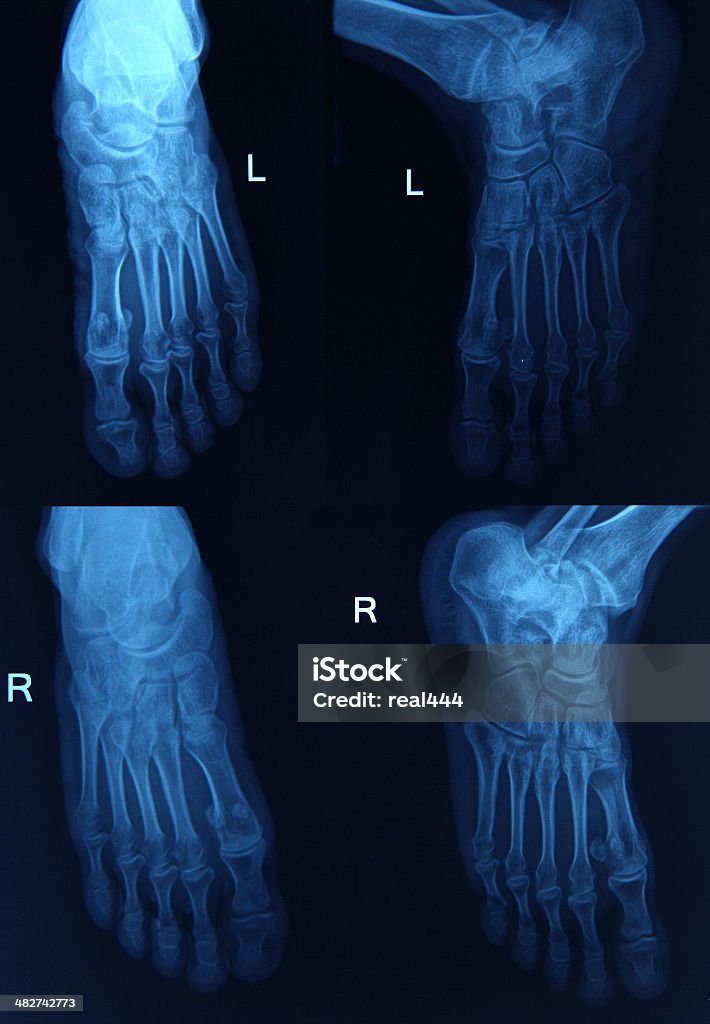 Imagen de rayos X de la pata - Foto de stock de Articulación libre de derechos