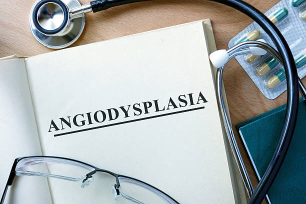 istock Angiodysplasia  concept. Book with stethoscope and pills. 482817166