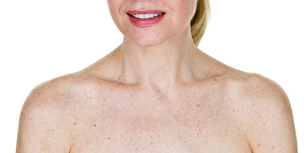 Age spots Closeup of a woman with age spots on her skin  chest torso photos stock pictures, royalty-free photos & images