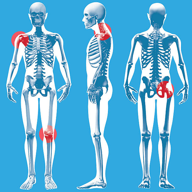 Figure Standing - Front, Side and Rear View (Dot-grid pattern) A stylized x-ray view of a Figure standing (dot pattern grid version) from the Front, Side and Rear. The 4 red circular highlights indicate potential injury /pain areas. knee to the head pose stock illustrations