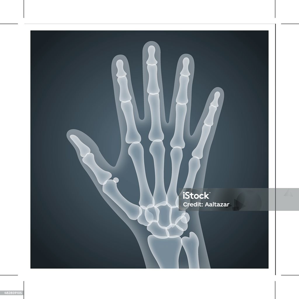 Menschliche Hand X-Ray - Lizenzfrei Röntgenbild Vektorgrafik