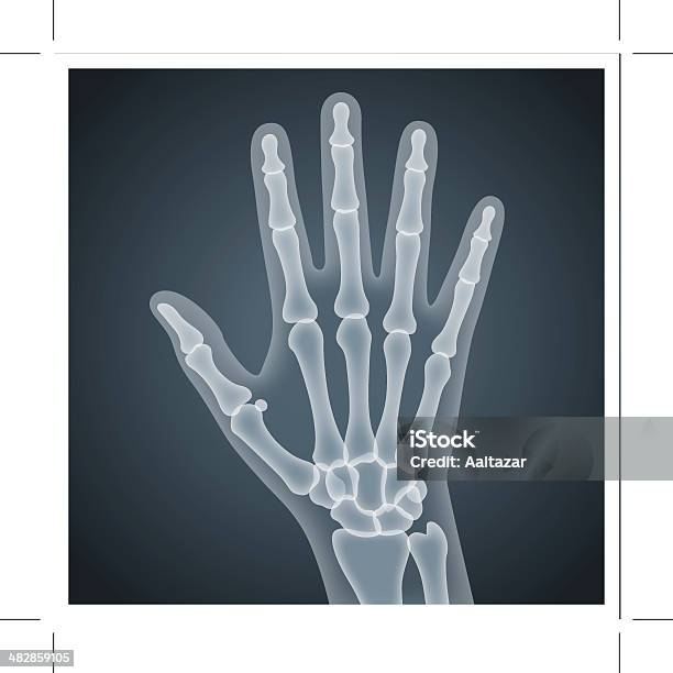 人間の手 X 線 - X線撮影のベクターアート素材や画像を多数ご用意 - X線撮影, レントゲン, 人体構造