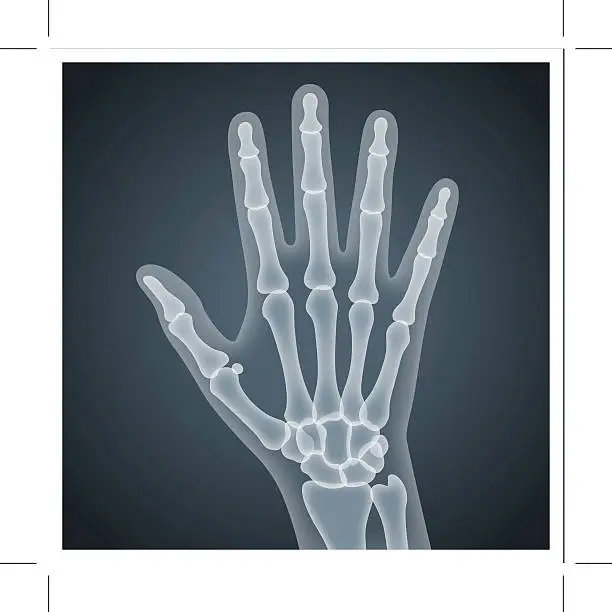 Vector illustration of Human Hand X-Ray