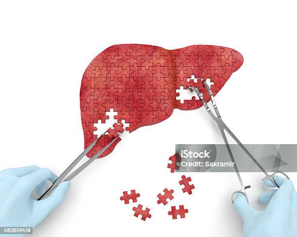 Liver Operation Stock Photo - Download Image Now - Liver - Organ, Hepatitis, Healthcare And Medicine