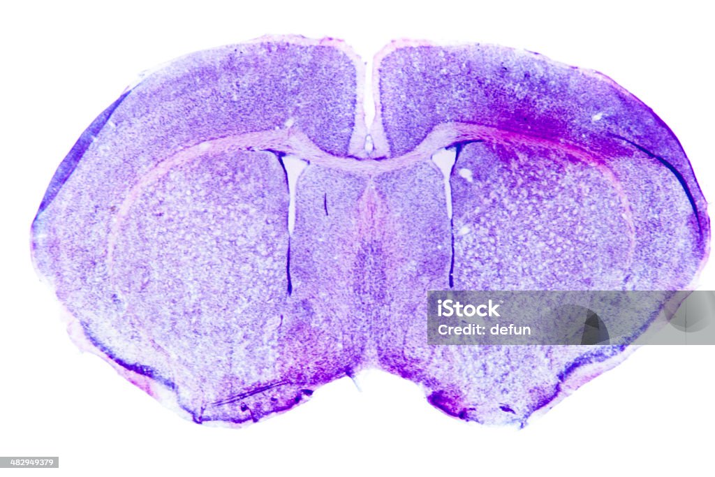 Micrograph of rat brain Micrograph of rat brain. Science cross section. Rat Stock Photo