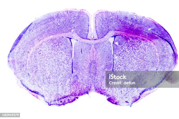 Micrograph Of Rat Brain Stock Photo - Download Image Now - Rat, Animal Brain, Animal Internal Organ