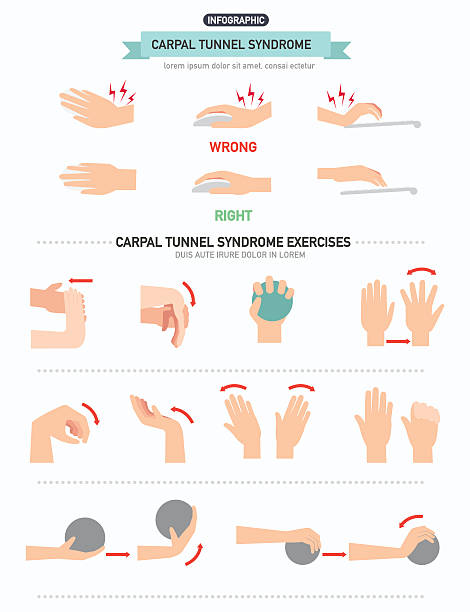 illustrazioni stock, clip art, cartoni animati e icone di tendenza di sindrome del tunnel carpale infografica - wrong injury