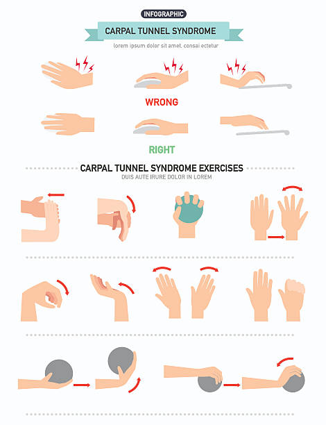 Carpal tunnel syndrome infographic Carpal tunnel syndrome infographic,vector illustration. wrist stock illustrations