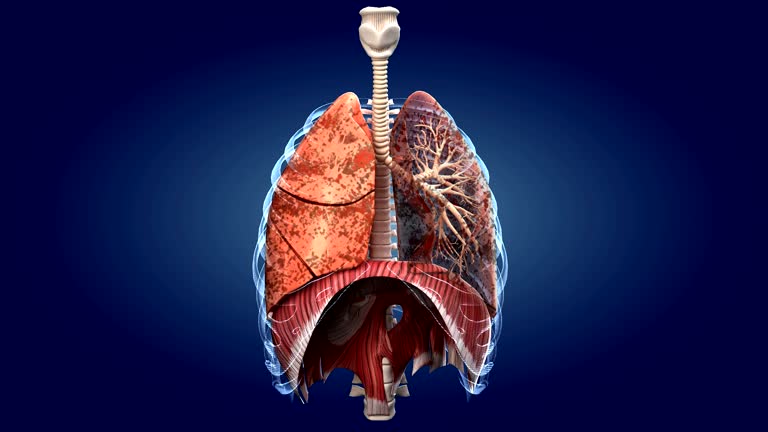514 Smokers Lungs Stock Videos and Royalty-Free Footage - iStock | Lung cancer, Heart disease, Healthy lungs 514 Smokers Lungs Stock Videos and Royalty-Free Footage - iStock | Lung cancer, Heart disease, Healthy lungs