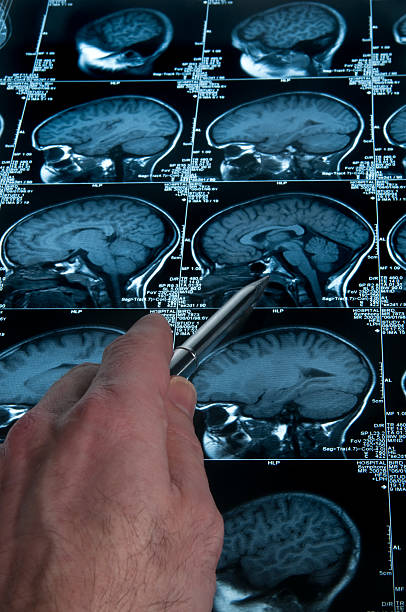 MRI Brain Scan of head and skull with hand pointing stock photo