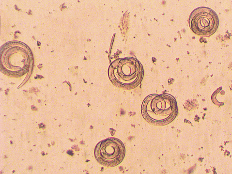 Trichinella spiralis - parasitic worm in muscle in microscope