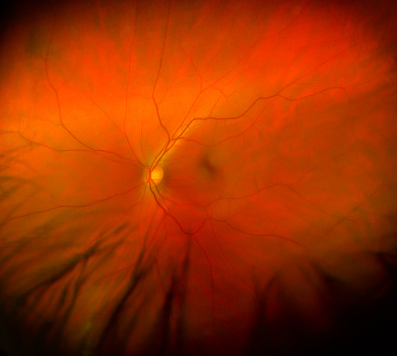 View inside of the human eye showing a healthy retina, optic nerve, and macula.