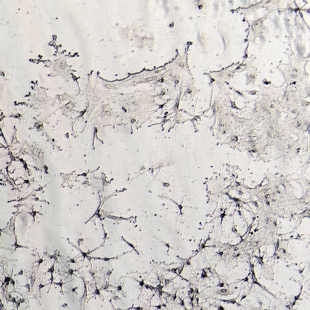 istock nerve cells of rat brain 483168055