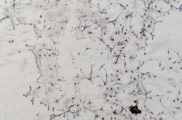 nerf cellules de rat cerveau - corpus striatum photos et images de collection