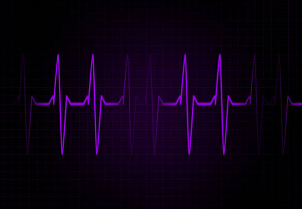istock Cardiac Frequency in purple Color 483309342