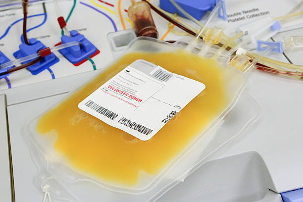 Human Blood Platelets bag of human blood platelets and plasma. blood plasma photos stock pictures, royalty-free photos & images