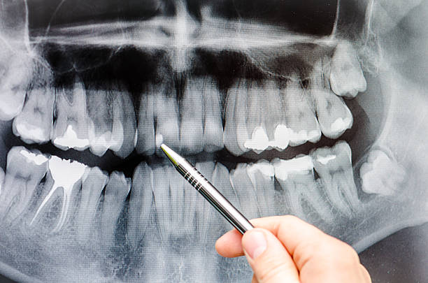 歯科歯を示すものに x 線画像 - radiologist cat scan x ray cat scan machine ストックフォトと画像
