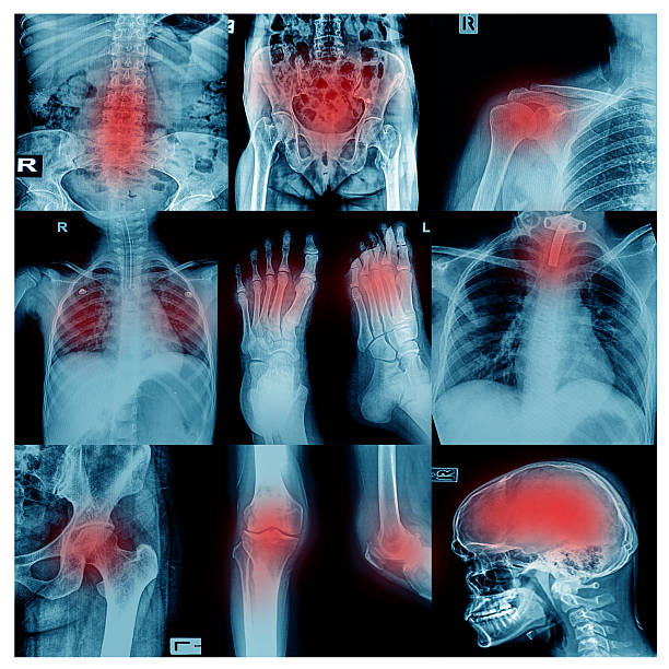 コレクションの x 線の複数の部品を提供 - cat scan pelvis hip human spine ストックフォトと画像