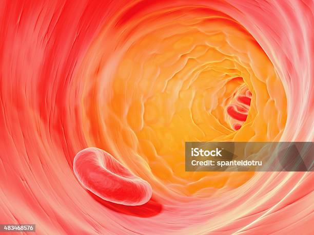 Cholesterol Plaque In Artery Stock Photo - Download Image Now - Cholesterol, Atherosclerosis, Plaque - Bacteria