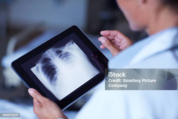 Die Mobile Röntgenapparate Anzeigen Stockfoto und mehr Bilder von Arzt - Arzt, Tablet PC, Röntgenbild