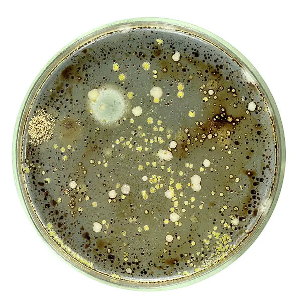 Oil oxidizing (degrading) bacteria and fungi from sea water grows on agar petri plate with small drops of crude oil. All dark spots and dots are petroleum drops. Isolation on a  white background.