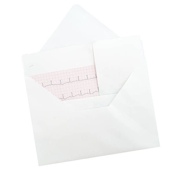 istock ECG, elelctrocardiogram in envelope isolated on white 483586356