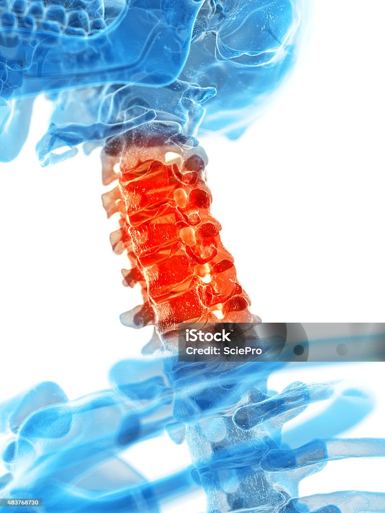 painful cervical spine medically accurate illustration - painful cervical spine 2015 Stock Photo