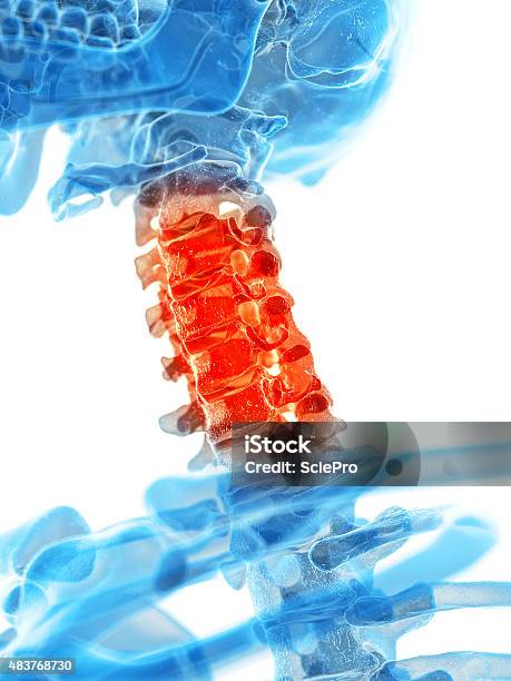 Painful Cervical Spine Stock Photo - Download Image Now - 2015, Anatomy, Biology