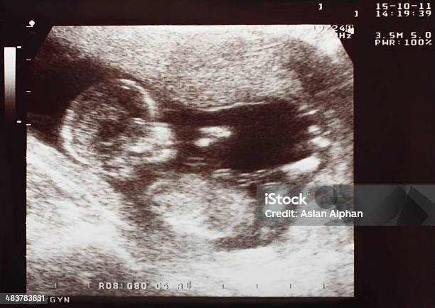 Baby Ultrasound Scan Stock Photo - Download Image Now - Ultrasound, Baby - Human Age, Chart