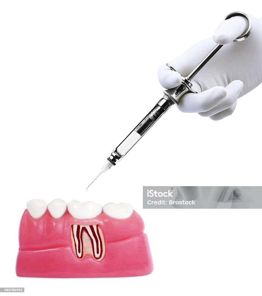 Dental treatment Dental treatment. Anatomy Stock Photo