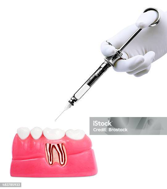 Dental Treatment Stock Photo - Download Image Now - Anatomy, Beauty, Cut Out