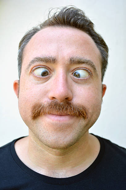 Косые глаза фото Косые глаза фото