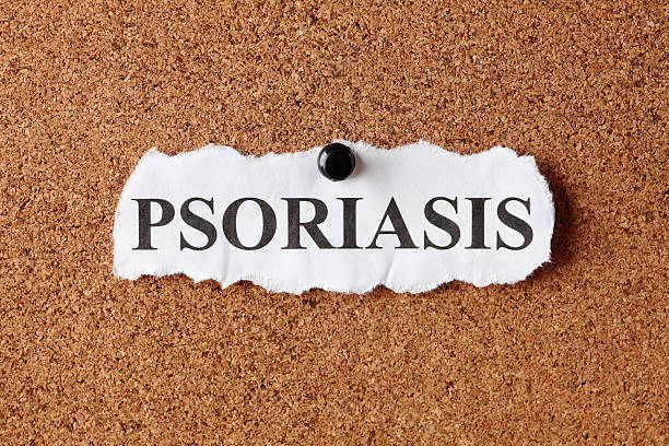 건선 - psoriasis straight pin message blackboard 뉴스 사진 이미지