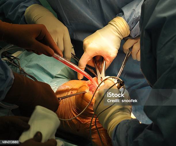 Prosthesis Of The Knee Hospital Operation Stock Photo - Download Image Now - 2015, Anatomy, Arthritis