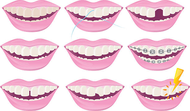 ilustrações de stock, clip art, desenhos animados e ícones de dental dentes - toothless grin