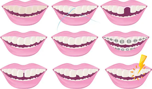 Vector illustration of Dental Teeth