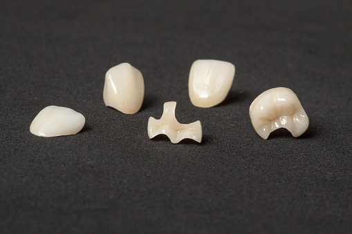 Crowns, inlays and veneers made of leucite ceramics in milling center