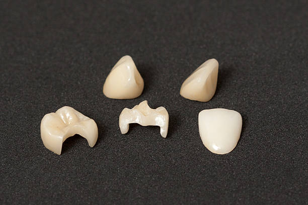 Crowns, inlays and veneers made of leucite ceramics in milling center