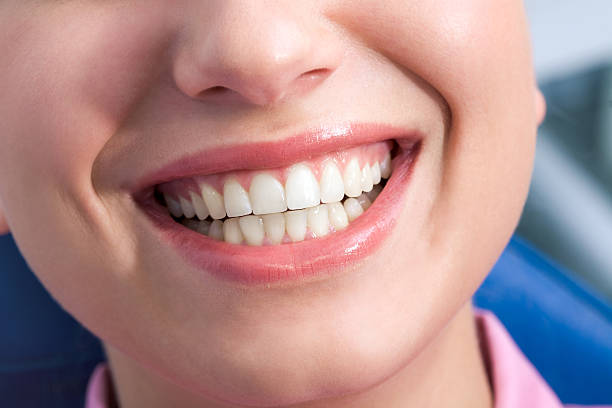 Close-up of happy female showing her healthy teeth in smile   Note to inspector: the image is pre-Sept 1 2009
