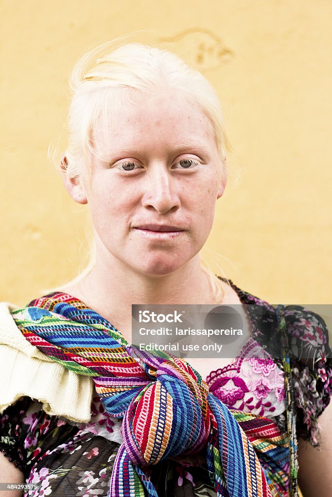 Portrait of an albino woman La Antigua Guatemala, Guatemala - September 16, 2013: A portrait of a Mayan albino woman from Guatemala wearing traditional clothes while she was selling her crafts during the week celebrations of the Independece of Guatemala. Albino Stock Photo