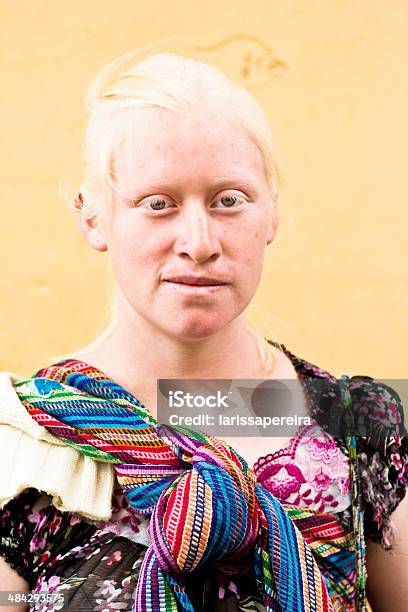Portrait Of An Albino Woman Stock Photo - Download Image Now - Albino, People, Adult