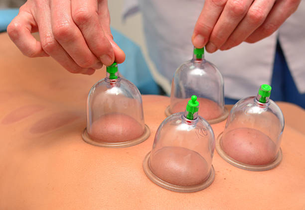 Cupping therapy, woman doctor removes cup from the patient's back