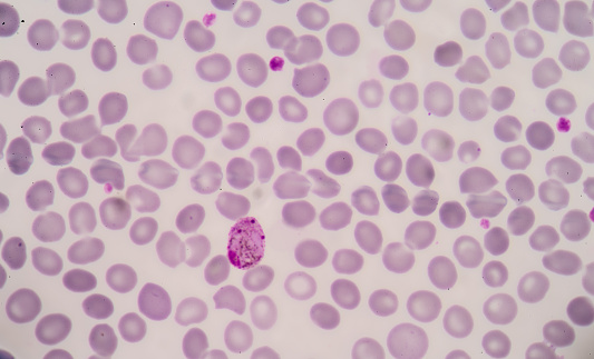 blood films for Malaria parasite.show malaria pigment.