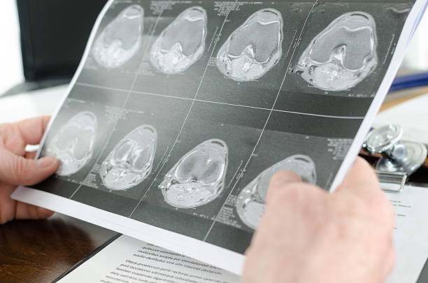 istock Doctor holding a MRI scan 484615484