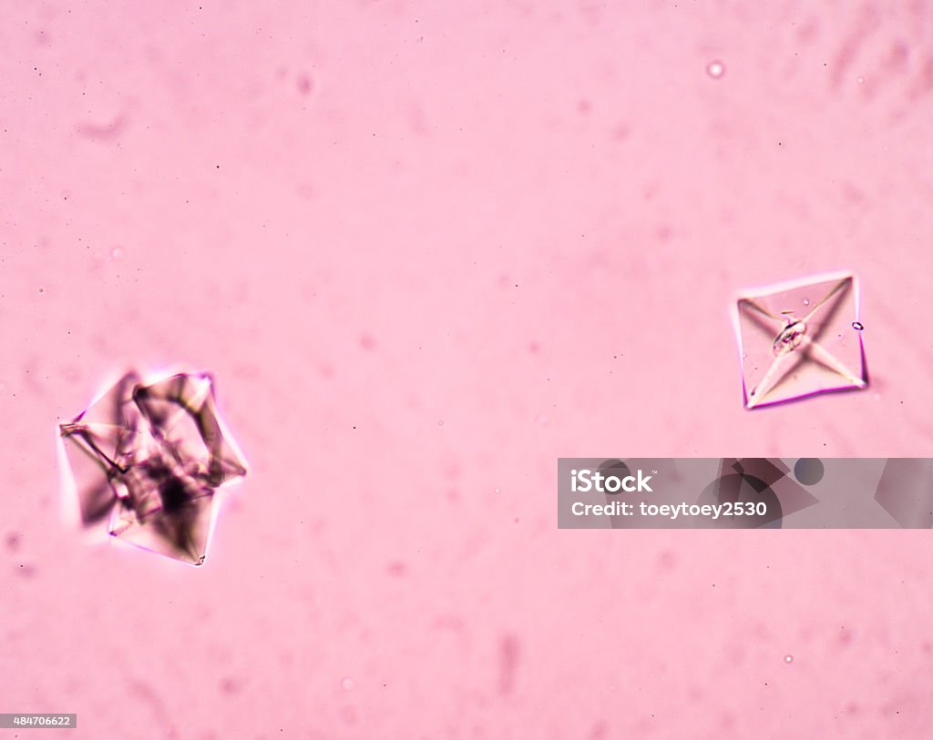 calcium oxalate crystal in urine analysis. 2015 Stock Photo