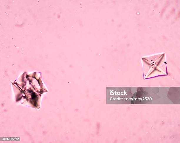 Calcium Oxalate Crystal In Urine Analysis Stock Photo - Download Image Now - 2015, Brown, Bundle