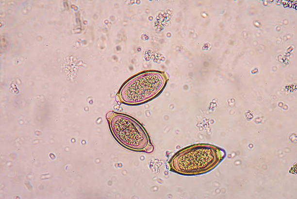 Trichuris trichiura eggs parasite. Trichuris trichiura has a narrow anterior esophageal end and shorter and thicker posterior anus. These pinkish-white worms are threaded through the mucosa. They attach to the host through their slender anterior end and feed on tissue secretions instead of blood. giardia lamblia stock pictures, royalty-free photos & images