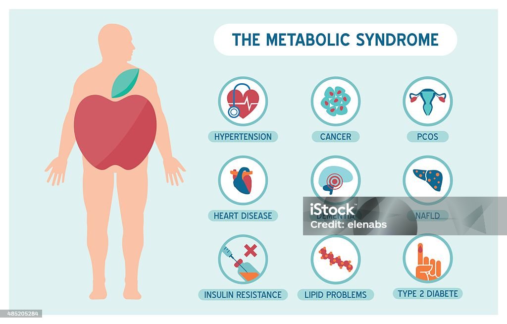 The metabolic sundrome The metabolic syndrome infographics with disease medical icons, fat male body and apple shape Metabolic Syndrome stock vector